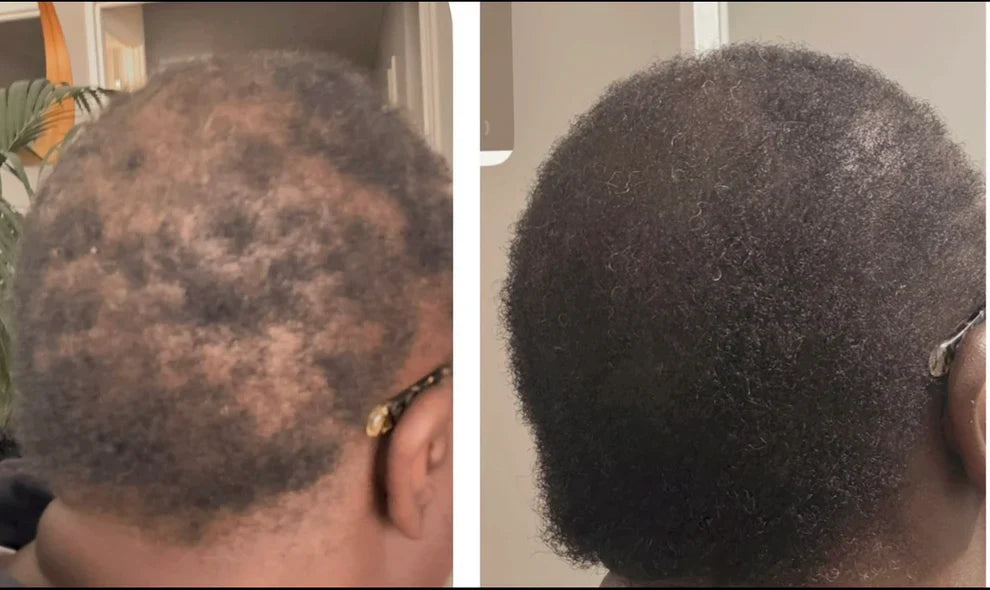BOOST HAIR Gélules – Formule Croissance & Réduction de la Chute