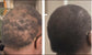 BOOST HAIR Gélules – Formule Croissance & Réduction de la Chute