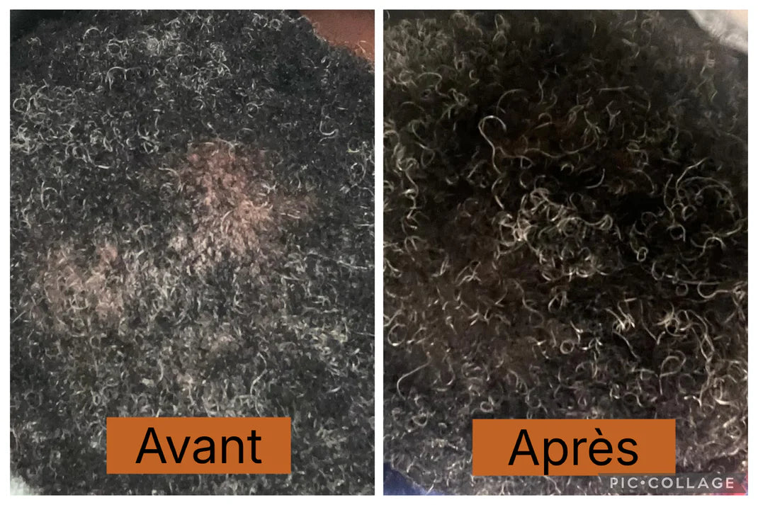 Sérum Capillaire - Restimule la Pousse & Limite la Casse